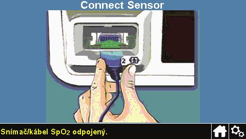 Ak sa snímač odpojí od monitorovacieho systému Ak sa snímač odpojí od monitorovacieho systému, zobrazí sa obrazovka na obrázku vpravo.
