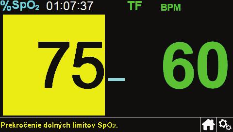 Ak sa spustí alarm SpO 2 Ak dôjde k vysokej alebo nízkej hodnote SpO 2, na mieste odčítania SpO 2 uvidíte žlté pozadie a v spodnej časti obrazovky sa zobrazí hlásenie.