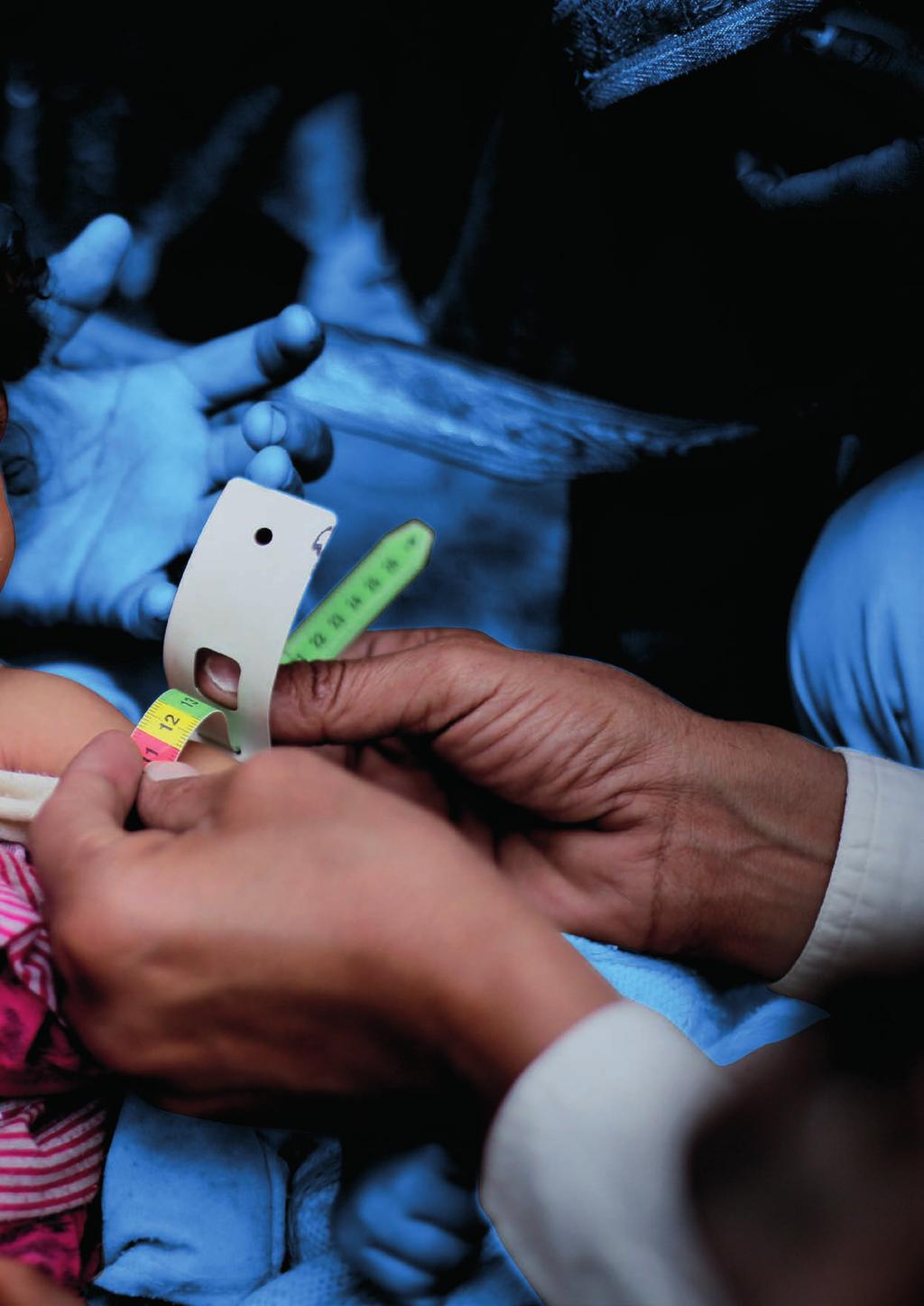 UNICEF proti cholere v Jemene zaistil: 75 centier pre liečbu črevných chorôb a cholery, vrátane vybavenia, 167 338 deťom mladším ako 5 rokov trpiacim akútnou ťažkou podvýživou potrebnú stravu a