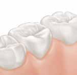 4 piliere prevencie zubného kazu Účinná ochrana pred zubným kazom Správna ústna hygiena (od prvého zuba) Nastavenie správnych výživových zvyklostí Návšteva v zubnej ordinácii od 1.