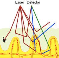 4.2. Popis přístroje PeriScan PIM 3 59 Obrázek 4.2. Vlevo: Princip laserového dopplerovského perfuzního zobrazování (LDPI).