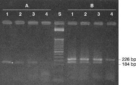 Dôkaz geneticky modifikovanej kukurice v potravinách polymerázovou re azovou reakciou OBR. 2. Výsledky analýzy referenèných materiálov pomocou jednoduchej PCR (A) a duplex PCR (B).