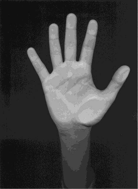 Obrázok 2.2: Fotografia dlane ruky vytvorená skenerom.
