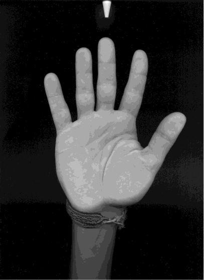 Na obrázku a) dlaň s prsteňom, na obrázku b) dlaň s náramkom.