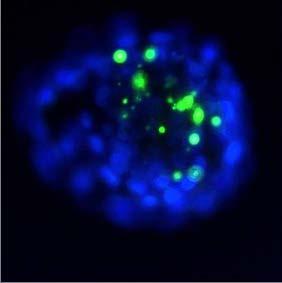 Analýza počtu buniek a výskytu apoptóz Blastocysta kravy ofarbená metódou TUNEL v kombinácie s farbivom