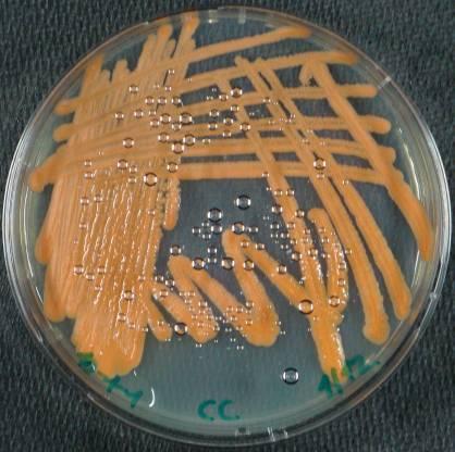 Ďalším rodom produkujúcim karotenogénne pigmenty je Cystofilobasidium, ktorého jednotlivé druhy boli izolované z planktónu v oceánoch.