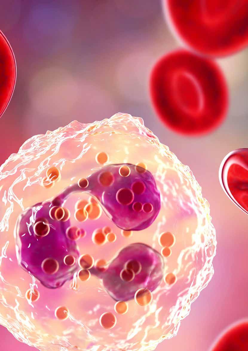 MUDR. EMÍLIA FLOCHOVÁ HEMATOLOGIČKA Ako dnes vyzerá život človeka s rakovinou krvi, konkrétne s mnohopočetným myelómom?