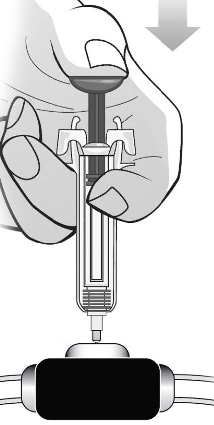 Vyberte naplnenú injekčnú striekačku z venózneho portu BEZ TOHO, aby ste uvoľnili piest. Uvoľnite piest, čím umožníte chrániču ihly ochrániť ihlu.