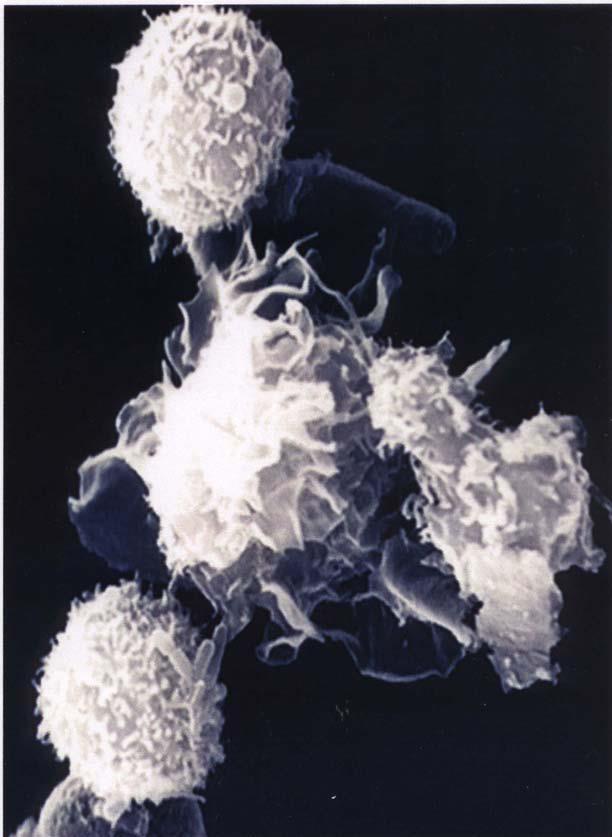 Dendritické bunky (DC) FUNKCIA: najvýkonnejšie APC schopnosť aktivovať naivné T