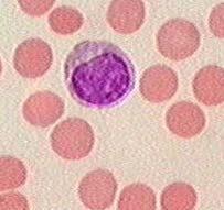 lymfocyty Ly : malý, stredný, veľký Malý 8-12μm.