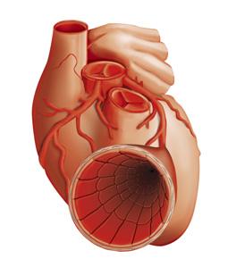 PREČO ZVIERATÁ NEDOSTANÚ SRDCOVÝ INFARKT, ALE ĽUDIA ÁNO Prečo ľudia dostanú srdcový infarkt, ale nie infarkt nosa diastola (fáza uvoľnenia) systola (fáza sťahu) Východisková slabosť cievnych stien