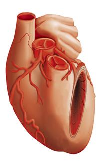 Koronárne artérie, keďže nimi srdce nepretržite pumpuje krv, sú najviac namáhané miesto, a práve tam sa vyskytuje najvyšší počet cievnych poškodení a opráv (aterómov). 3.