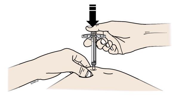 Dôležité: Vytvorenú riasu počas aplikácie stále držte. 3. krok: Injekčná aplikácia G.