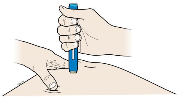 3. krok: Injekčná aplikácia G. Natiahnutú kožu alebo riasu držte.