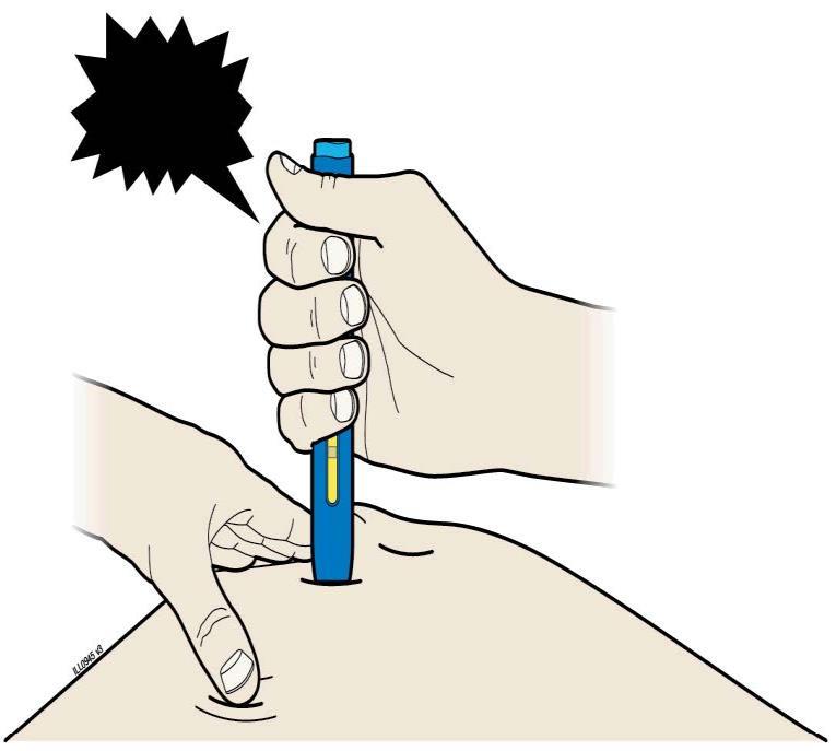 J. Počas injekcie udržiavajte tlak na kožu. Vaša injekcia trvala asi 10 sekúnd.