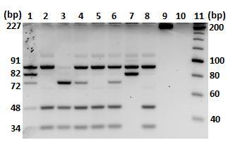 MATERIÁL A METÓDY 1. PCR-RFLP (Restriction Fragment Length Polymorphism) Molekulárno-genetická analýza APOE a APOB-100 kódujúcej sekvencie je založená na metóde PCR-RFLP.
