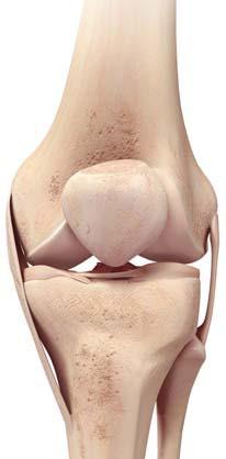 Kolenný kĺb a jeho zloženie Prečo je potrebný umelý kolenný kĺb? Z čoho sa skladá kolenný kĺb?