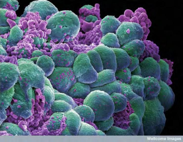 Cirkulujúce nádorové bunky Circulating Tumor Cells (CTC) Kološtová K, Pintérová D, Bobek