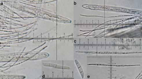 Bazálna stróma má textúru epidermoidea. Dvojvrstvové, 60 80 µm široké excipulum má vonkajšiu vrstvu zloženú zo žltých, 3 4 µm širokých, husto a paralelne poukladaných hýf, ktoré tvoria textúru oblita.