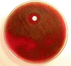 Streptococcus pseudopneumoniae identifikácia ako viridujúce streptokoky alebo ako atypické pneumokoky S. oralis / S.