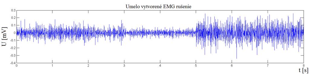Model výkonového spektra EMG rušenia môžeme vidieť na obrázku č. 5.2 v porovnaní s výkonovým spektrom reálneho EMG. Ako môžeme pozorovať na obrázku č. 5.3, výkon šumu sa postupne mení.