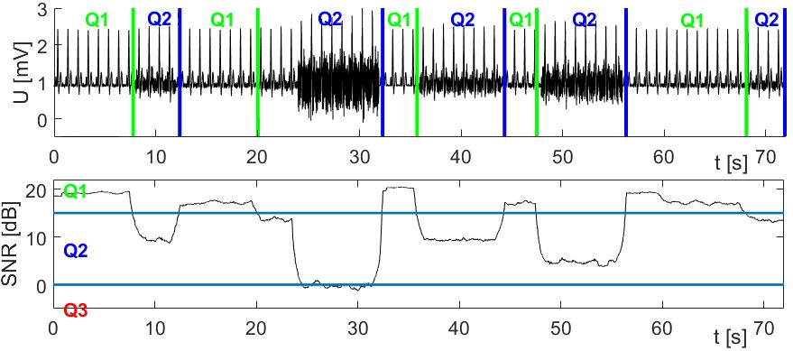 Na obrázku č. 6.19 môžeme vidieť rýchle zmeny kvality medzi kategóriami Q2 a Q1. Signál obsahuje 10 segmentov. Obr. 6.19: Hore: vstupný zašumený signál zaradený do kategórií kvality, dole: odhad SNR - čierna, hranice oddeľujúce kategórie kvality - modrá 6.