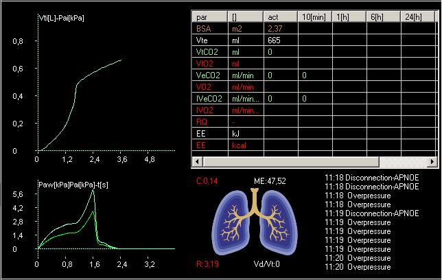 Moni Obrázok 22. V mix okne sa zobrazí kombinácia kriviek Cst, Paw, Pa a tabuľka metabolického kalkulátora, ak ventilátor obsahuje analýzu CO2.