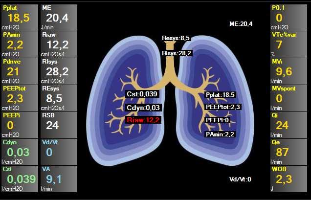 Kliknutím na model pľúc sa zobrazí plný monitoring parametrov: ME - mechanická energia Vd/Vt - Physiological dead space / tidal volume volumetrická kapnografia (Bohr) Pplat -
