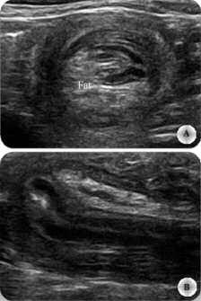 2 Normálne rozmedzie hrúbky črevnej steny (mm) v rôznych segmentoch tráviaceho traktu psov v závislosti od telesnej hmotnosti (5).