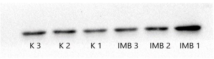 Obrázok 12: Denzita pruhov (zhora nadol) Pan-Aktínu, Troponínu I a Troponínu T K - kontrolné vzorky, IMB