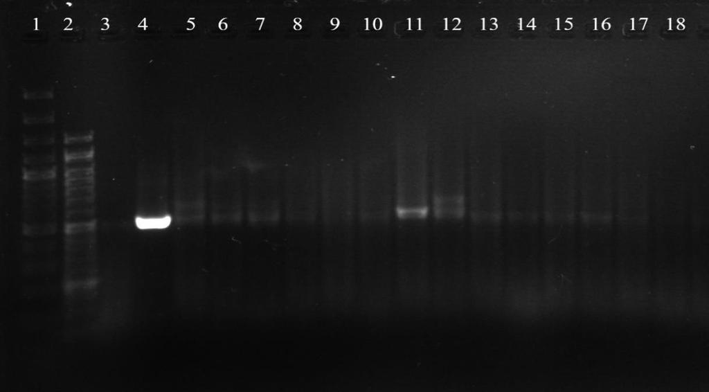 500 bp Beh číslo Vzorky DNA Označenie PCR produkt 1 DNA štandard 50 bp 2 DNA štandard 100 bp 3 Negatívna kontrola - 4 Pozitívna kontrola +++ 5 9A + Citrónová kôra 6 9B + 7 11A + Krémy Mentha Piperita