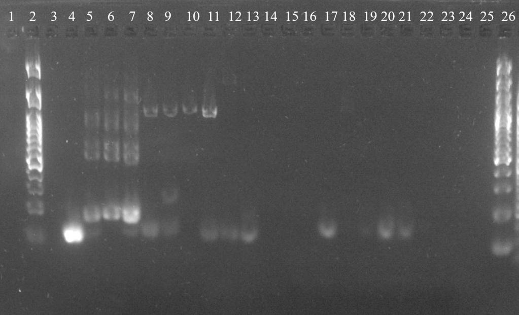 Produkty PCR boli nanesené v množstve 10 µl na 1,8 % agarózový gél a bola prevedená elektroforéza. Výsledky sú zobrazené na Obrázku 31.