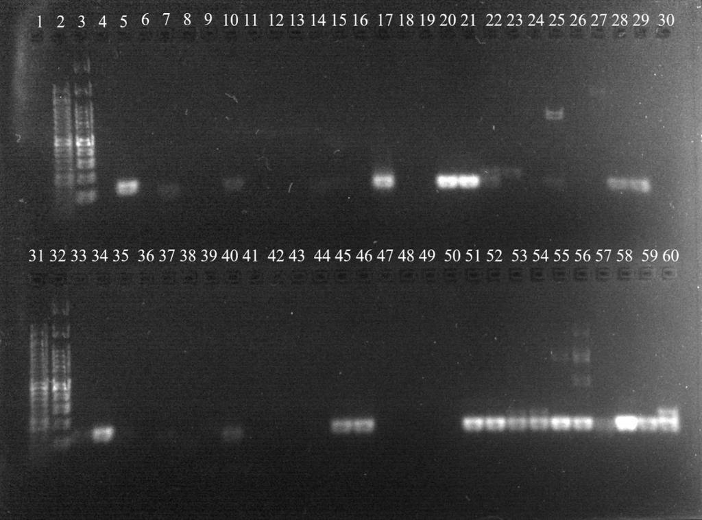 122 bp 122 bp Obrázok 34 - krémy od 22A Obrázok 35 Agarózová gélová elektroforéza produktov PCR, použitie primerov Lim2FR