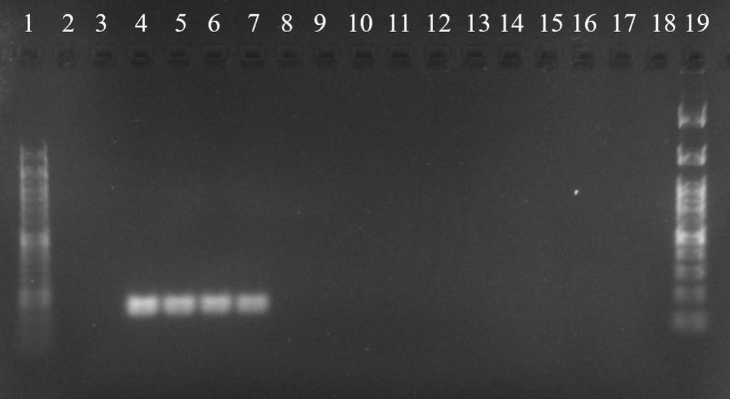 154 bp Beh číslo DNA Označenie PCR produkt 1 štandard 50 bp 2 x - 3 negatívna kontrola - 4 Pozitívna kontrola PK1 + 5 Rastlinná Pozitívna kontrola PK2 + 6 DNA Pozitívna kontrola LM + 7 Pozitívna
