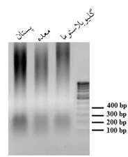 RT-PCR.