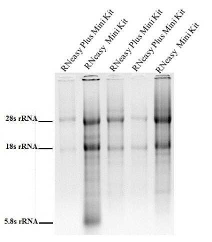 1 5/8s 18s 28s RNA. RNA RNeasy Plus Mini RNeasy Mini cdna. PCR TBP PCR 128.