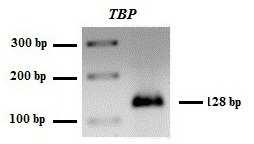 A B (B RNeasy Mini (A RNA TBP RT-PCR.7.RNeasy Plus Mini RNA.