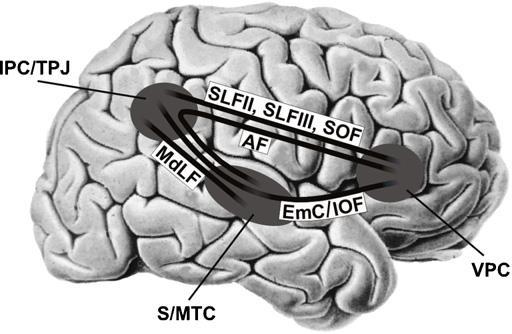 Obrázok 1 Nákres perisylvianskej neurálnej siete, IPC inferiórny parietálny kortex, TPJ temporo-parietálna junkcia (Karnath a Rorden, 2012, s.