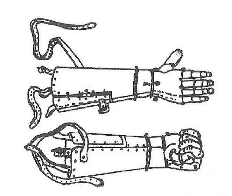 Časom sa mechanizmus protéz horných končatín ďalej vyvíjal.