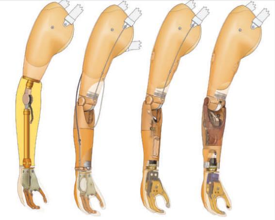 Obrázok 9 Kozmetická, ťahová, hybridná a myoelektrická protéza (zľava) Zdroj (12